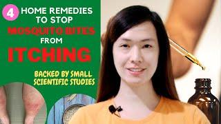 How to Stop Mosquito Bites from Itching: 4 Home Remedies Backed by Small Scientific Studies