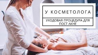 У КОСМЕТОЛОГА: Процедура для Пост Акне | Anastasia Talan