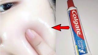 Colgate for face whitening | Colgate paste for skin whitening | Colgate for face