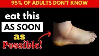 SWOLLEN LEGS? Eat THESE Fruits NOW for FAST Leg Swelling Relief!