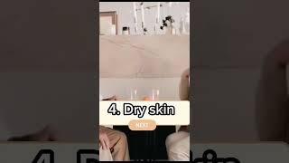7 Signs of ageing by Nurse Marky #youtube #aged #health