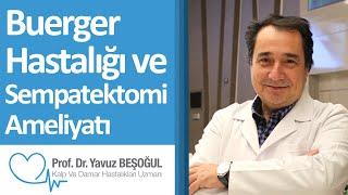Buerger Hastalığı ve Sempatektomi Ameliyatı | Prof. Dr. Yavuz Beşoğul