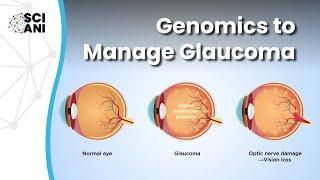 Could our genes hold the key to improved understanding and management of glaucoma?