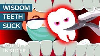 Why Do Wisdom Teeth Suck?