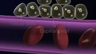 Hypertension - Circulatory System