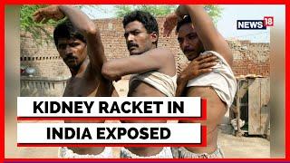 Kidney Racket In India | India's Biggest Kidney Racket Exposed | Human Organ Trafficking | News18