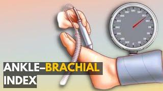 Ankle–Brachial Index: Everything You Need to Know