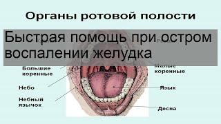 Быстрая помощь при остром воспалении желудка