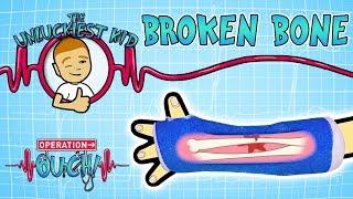 Science for kids |  BROKEN BONES- Unluckiest Kid | Experiments for kids | Operation Ouch