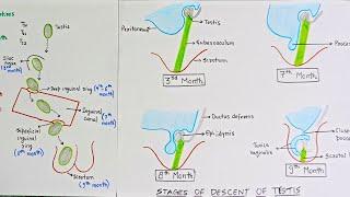 DESCENT OF TESTIS