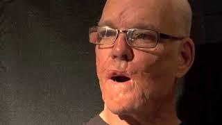 Bob Perkins - Operation Smile Interview August 12, 2012