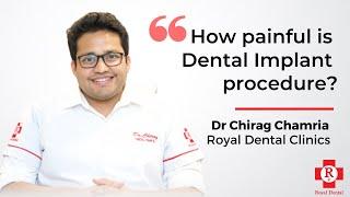 How painful is Dental Implant procedure? Dr. Chirag Chamria | Royal Dental Clinics