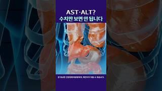 ALT·AST? 수치만 보면 안 됩니다  #울산내과#간수치 #간염 #건강검진 #간기능개선