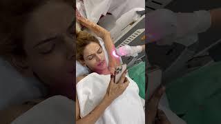 Hair removal laser at TRANSFORM CLINIC AT MULUND 086551 17797 #shorts #khushi #youtube #trending