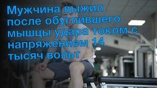 Мужчина выжил после обуглившего мышцы удара током с напряжением 14 тысяч вольт