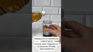 ИЗБАВИТЬСЯ ОТ ВАРИКОЗА ЭТО ПРОЩЕ ЧЕМ КАЖЕТСЯ