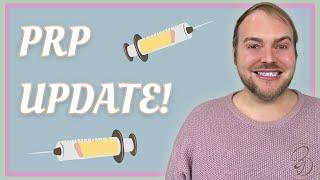 PRP Treatment For Hair Loss Update | Eight Month Update