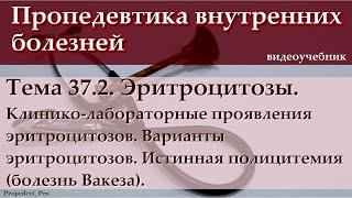 Тема 37.2. Эритроцитозы. Клинико-лабораторные проявления эритроцитозов. Варианты эритроцитозов.