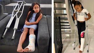 The Girl with a BROKEN LEG, the Full Movie | FamousTubeFamily