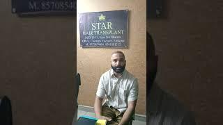 Best hair transplant center in Chandigarh Mr. Sahil (happy patients )