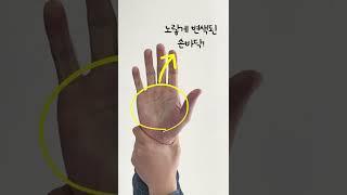 수족냉증 자가진단하는 방법! (수족냉증의 의심 된다면 따라해보자!)