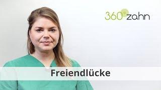 Freiendlücke - Was ist eine Freiendlücke? | Dental-Lexikon | 360°zahn