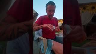 Снимаем швы в домашних условиях.