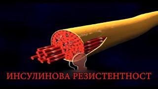 ИНСУЛИНОВА РЕЗИСТЕНТНОСТ – КАКВО ТРЯБВА ДА ЗНАЕМ?