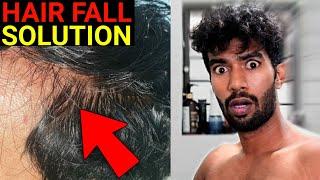 5 Steps To Stop Hairfall Instantly | Men's Lifestyle | தமிழ்