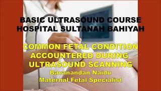 COMMON FETAL CONDITIONS DIAGNOSED ON ULTRASOUND