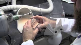 Model Fabrication Using the MainStay Disposable Articulator