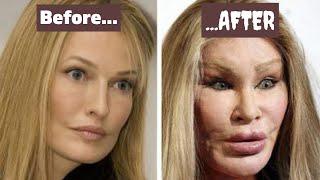 The problem with plastic surgery | Opt into Beauty