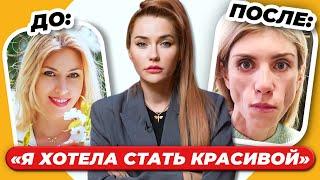 ЖИЗНЬ БЕЗ ЛИЦА: До и После пластики  | ошибки пластических хирургов