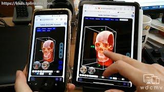 Using Web DICOM Viewer on iPad and Android phone (short version)