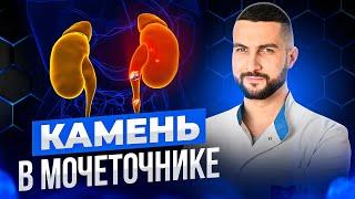 Что происходит после удаления камня мочеточника?