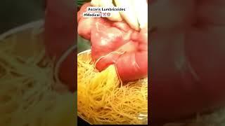Ascaris Lumbricoides Parasito  #shorts #information #content
