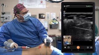 Ultrasound Guided BBL Procedure