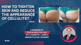 How to tighten skin and cellulite reduction in NYC - A webinar by Dr. Ron Shelton