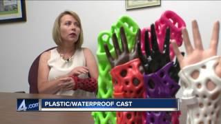 Plastic/Waterproof Cast Great for Kids and Summer