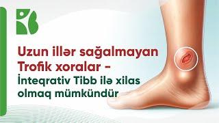 Şəkər xəstələrinin ayaqlarında sağalmayan yaralar – İnteqrativ Tibb ilə necə qarşısını almaq olar?