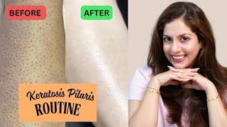How to Treat Strawberry Skin at Home Treatment | Nipun Kapur