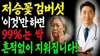 집에서 저승꽃 검버섯 쉽게 없애는 방법! 검버섯, 기미, 점 없애는 천연 특급 비법! 피부과에 비싼돈 주지마세요. 20년이나 젊어졌어요!ㅣ노년피부건강ㅣ검버섯ㅣ노화예방ㅣ오디오북