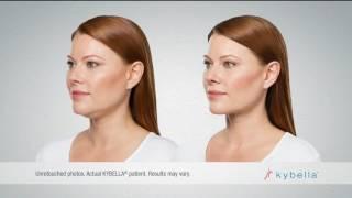 Kybella Double Chin Fat Reduction Reduction Commercial