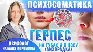 Герпес на губах, в носу/ Психосоматика/ Причина и как лечить