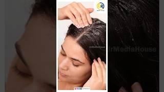 White Hair Problem Solution Is Here | UR Media House