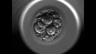 Single Embryo Transfer