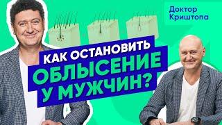 Настоящая причина мужского ОБЛЫСЕНИЯ. Как остановить выпадение волос у мужчин?