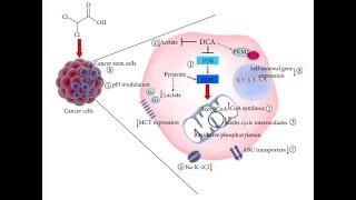 Dichloroacetate for Cancer care