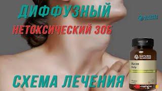 Диффузный нетоксический зоб.  Схема лечения.