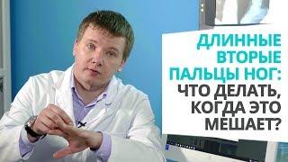 Длинные вторые пальцы ног: что делать, когда это мешает?  Доктор Алексей Олейник